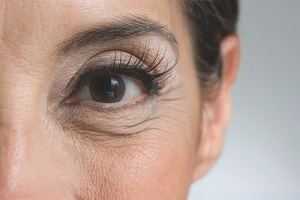 Paano alisin ang mga facial wrinkles sa paligid ng mga mata