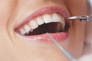 Paano mapupuksa ang sakit na periodontal