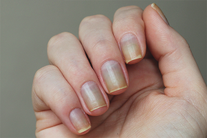 Paano ibalik ang mga kuko pagkatapos ng gel polish