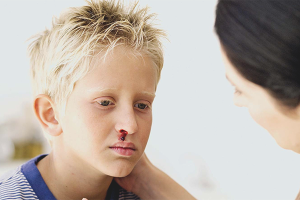 Epistaxis sa mga bata