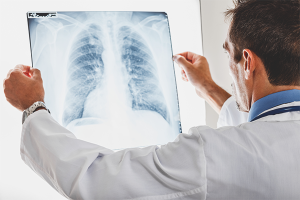 Paano makilala ang pulmonya