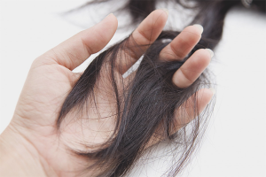 Pagkawala ng buhok pagkatapos ng panganganak