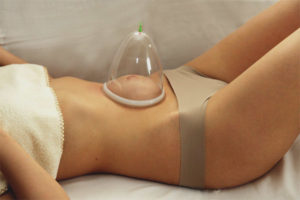 Masahe sa mga cellulite bank