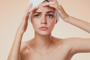 Ang acne sa noo sa mga kababaihan