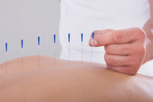Ang mga benepisyo at pinsala ng acupuncture
